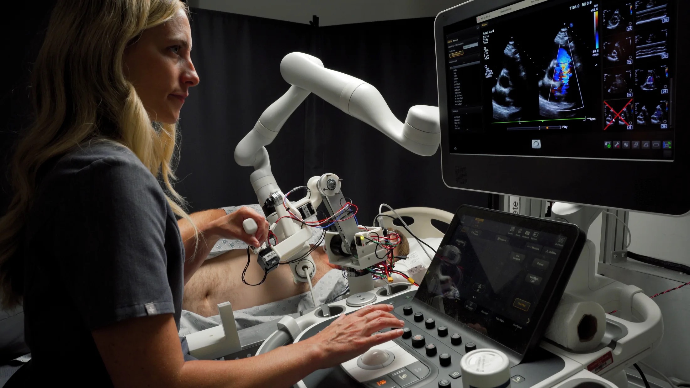 Sonographer working with robotic-assisted ultrasound